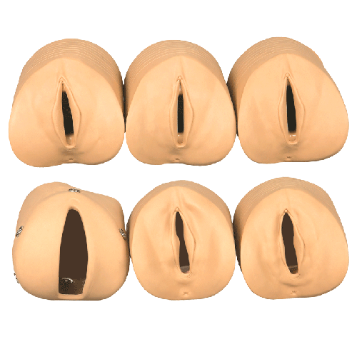產(chǎn)前宮頸變化與產(chǎn)道關(guān)系模型