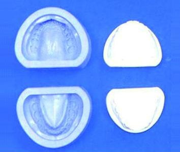 標(biāo)準(zhǔn)牙頜硅橡膠陰模
